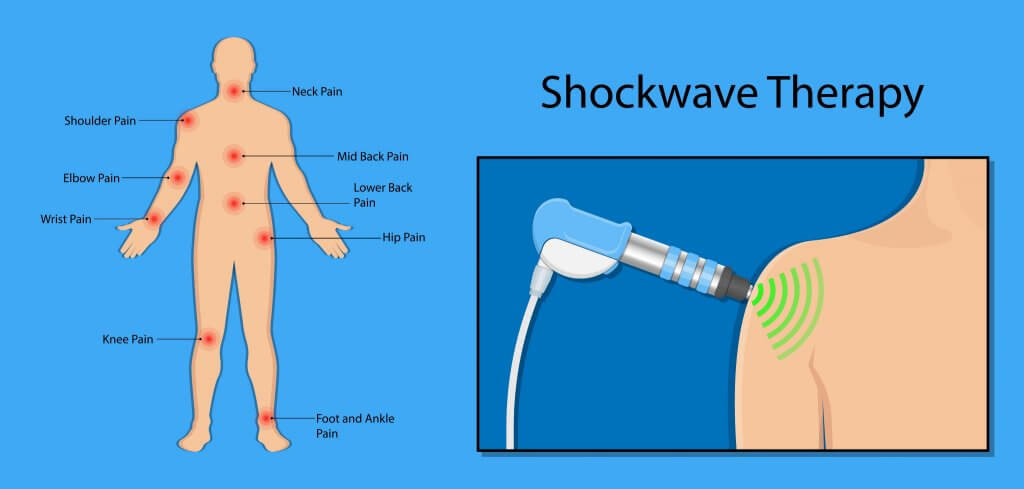 NEW Shockwave Therapy Machine Relaxation Treatments Back Pain Relief Body  Relax Muscle Massager Health Physiotherapy Shock Waves